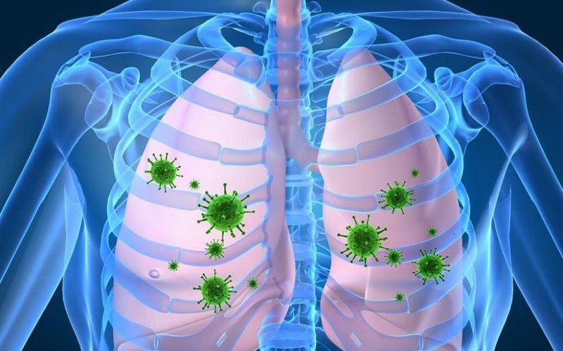 nguy cơ viêm phổi